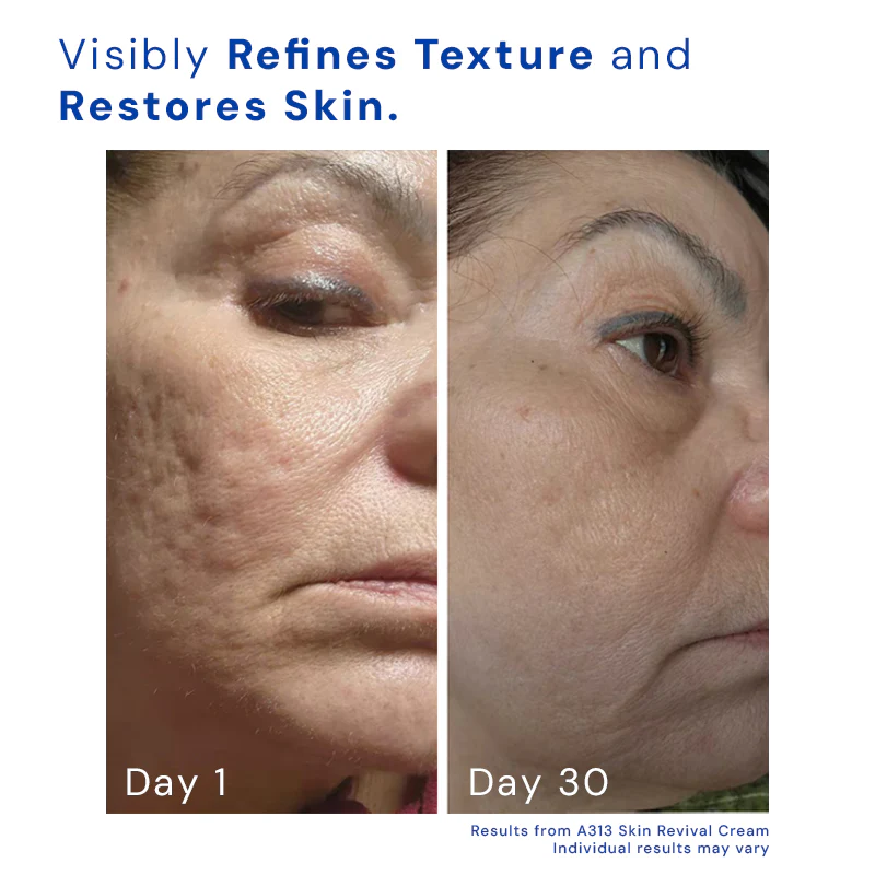 Retinol Skin Revival Cream