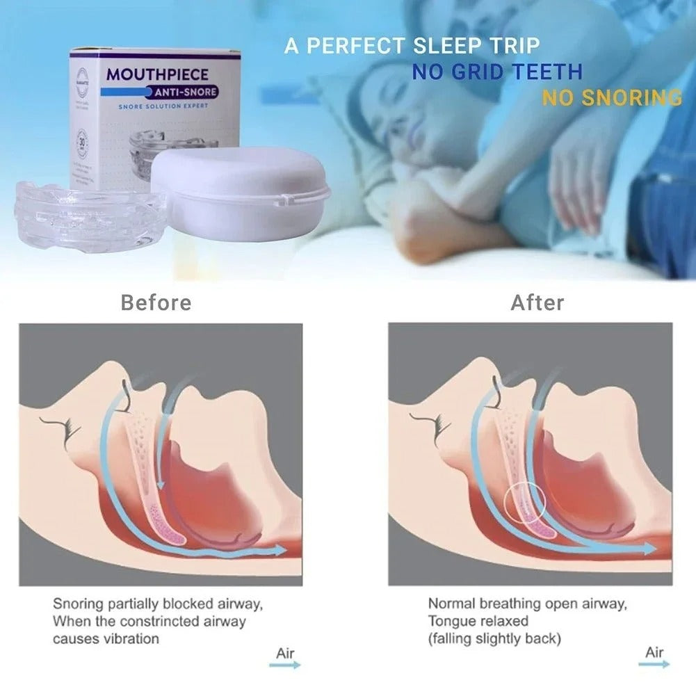 SleepQuiet™ Anti-Snore Mouthpiece