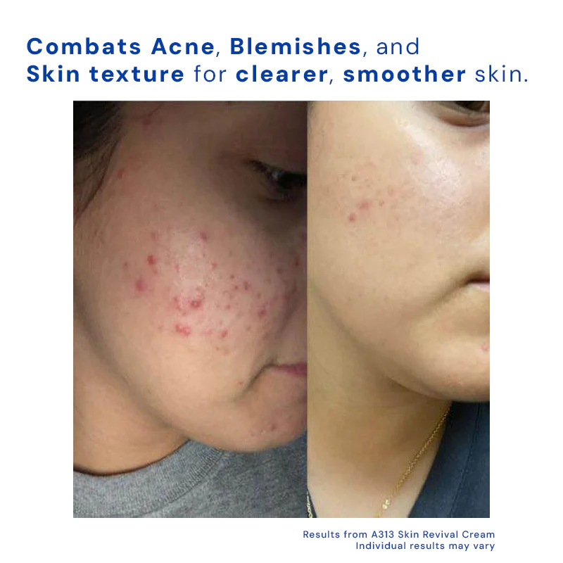 Retinol Skin Revival Cream