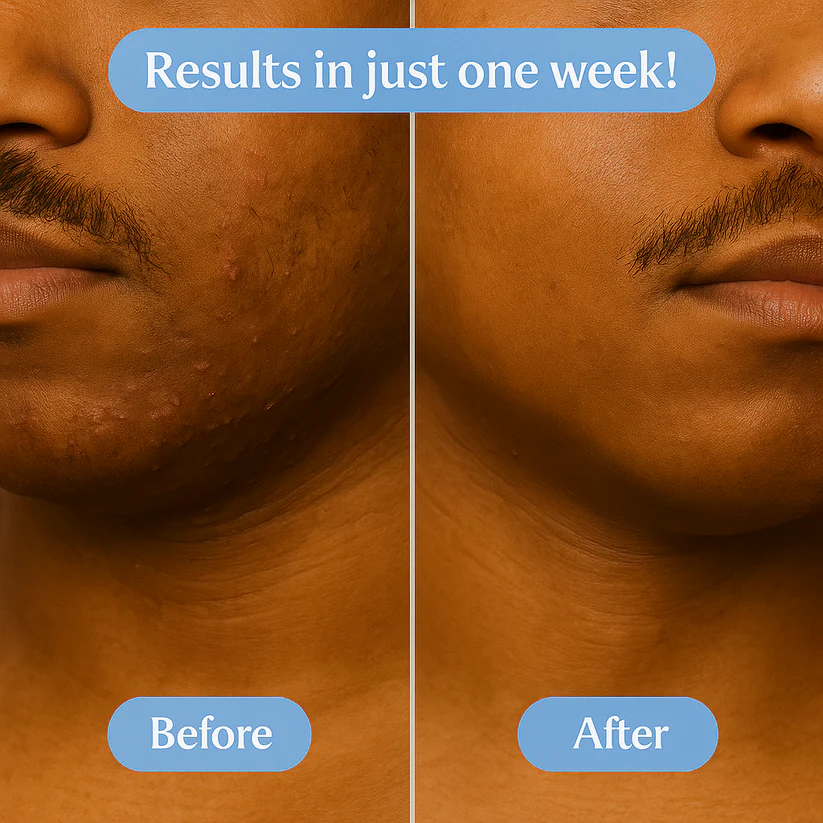 Mastara™ Smoothing Solution
