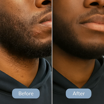 Mastara™ Smoothing Solution