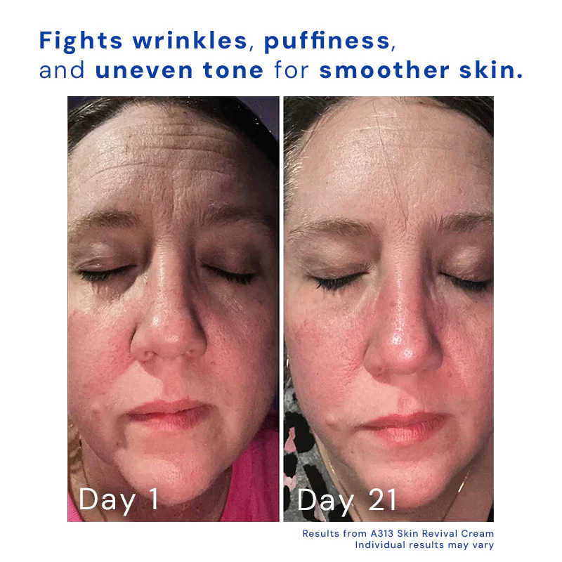 Retinol Skin Revival Cream