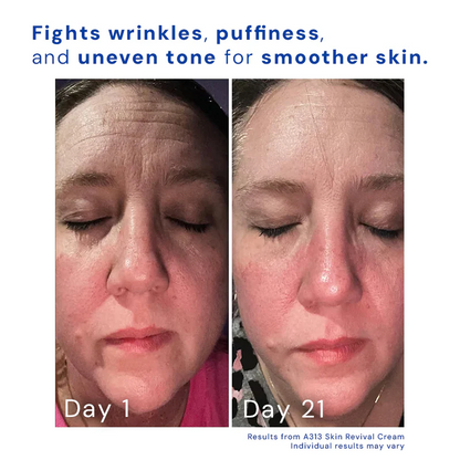 Retinol Skin Revival Cream